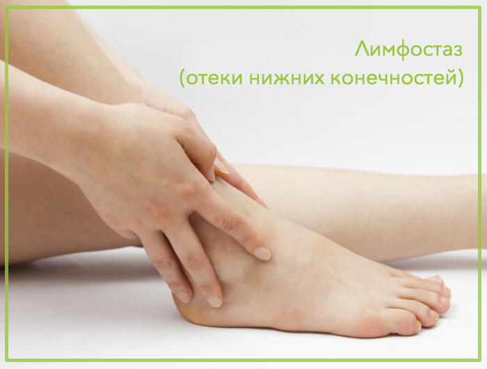 Лимфостаз и отечность ног – Родионов Алексей. Сосудистый хирург, флеболог