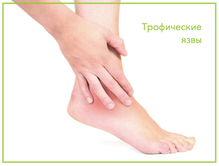Трофическая язва на ноге: причины, симптомы и методы терапии